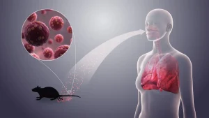 3 killed by Hantavirus en route to West Africa